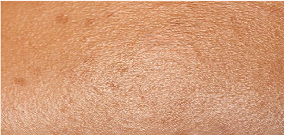 skin texture skin texture